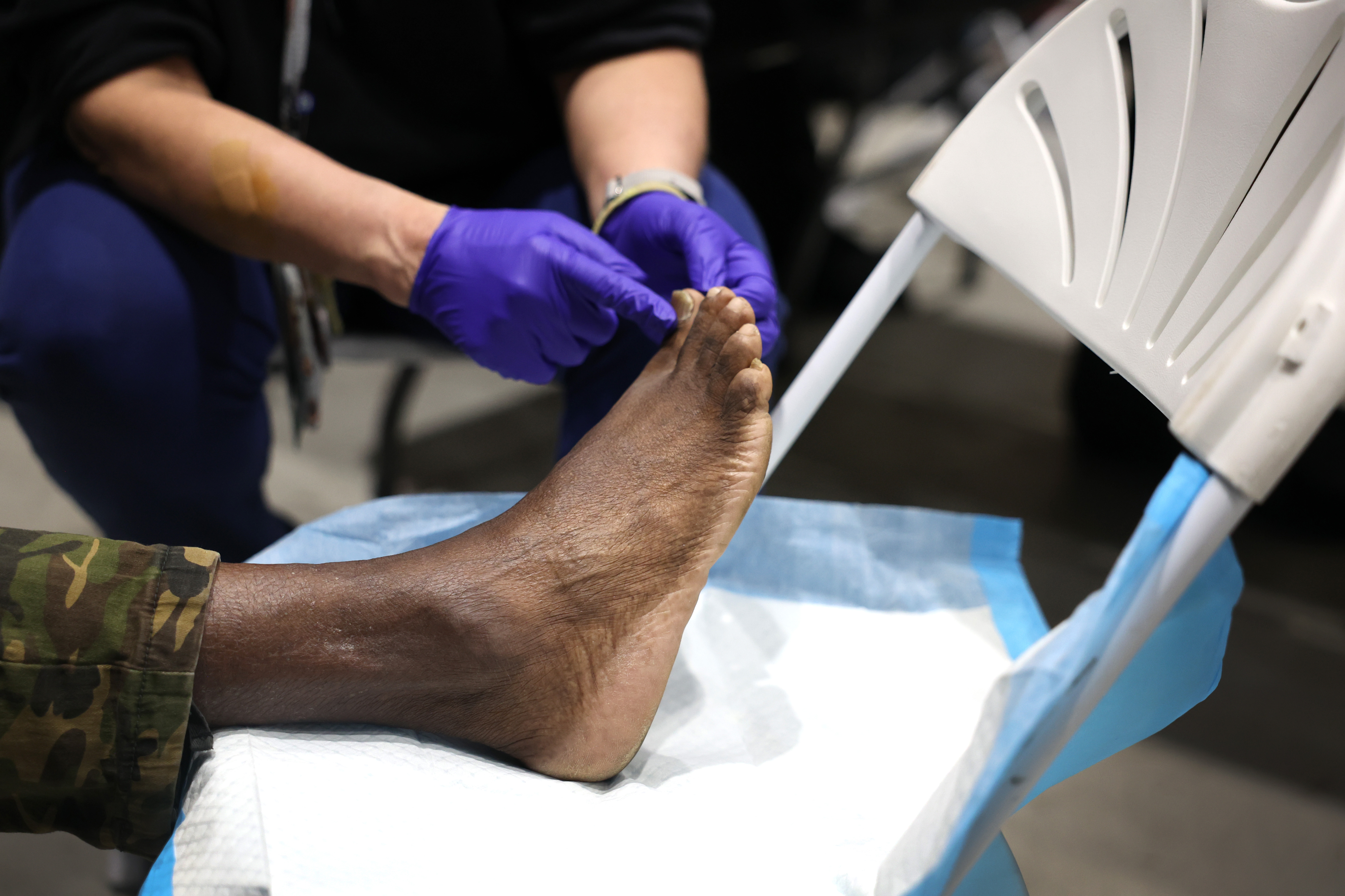 Military veterans are treated at a podiatry clinic during a Stand Down event designed to help veterans who are homeless or housing insecure on June 16, 2023 in Chicago, Illinois. (Photo by Scott Olson/Getty Images)